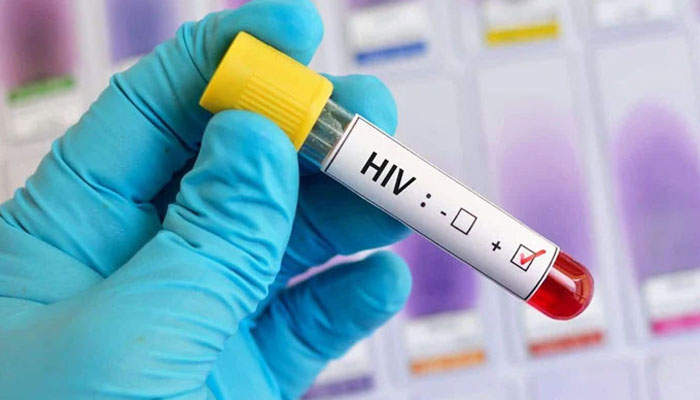 hiv