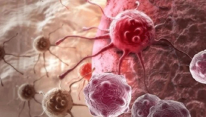 cancer