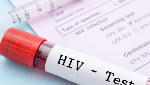 hiv