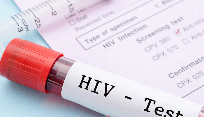 hiv