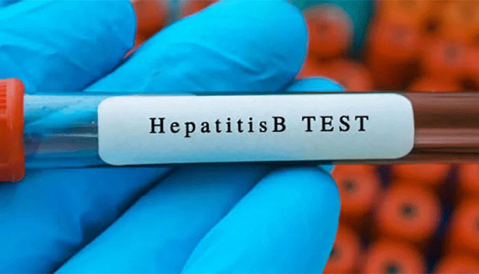 hapatitis