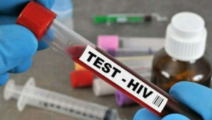 hiv