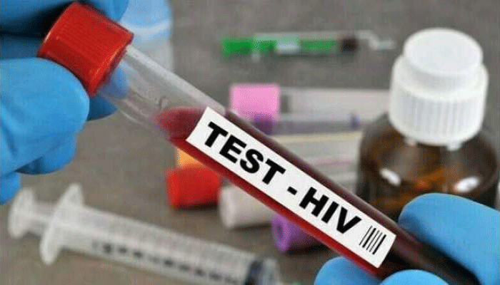 hiv