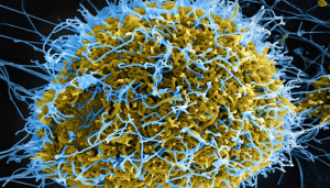 polio