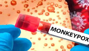 MONKEY
