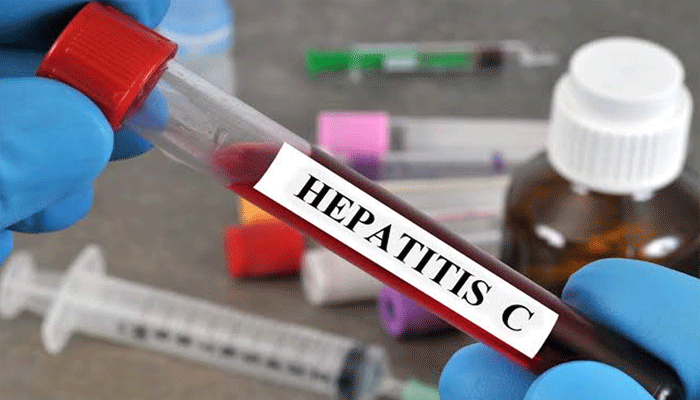 hypatitus