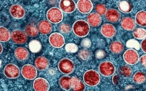 mpox